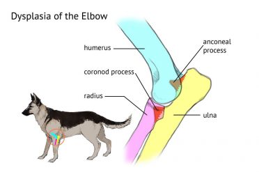 Elbow Dyslapsia