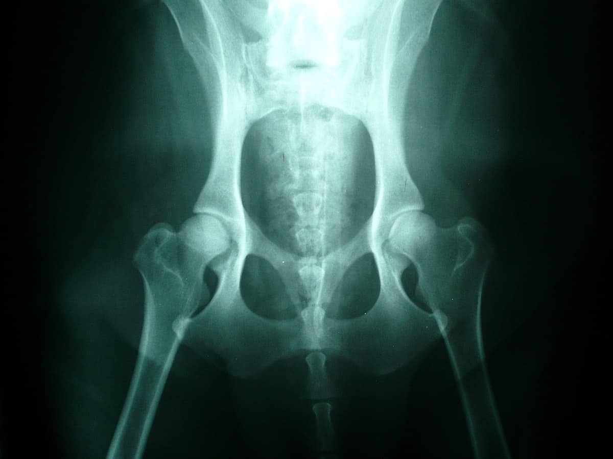 Unilateral Hip Dysplasia in Dogs (Nutrition, Excercise, and Pain Relief